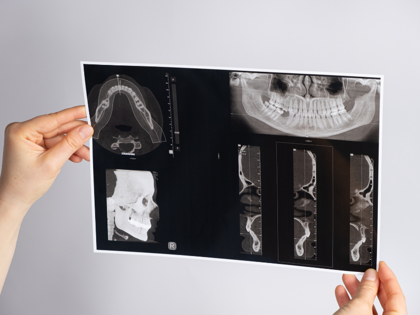 Kraniomandibuläre Dysfunktion im Workshop zum Thema CMD